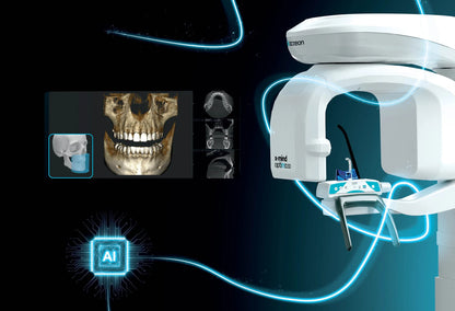 Acteon X-MIND® Optima 3D PAN CBCT with Ceph, Floor Mounted or with Free Standing Base 100-240V + Work Station + Monitor - W1203010*
